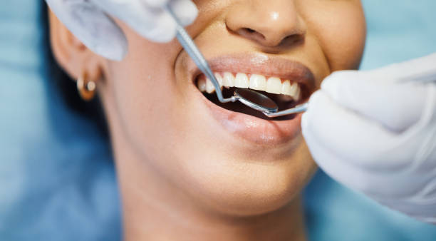 Best Emergency Dental Care for Broken or Chipped Teeth in El Cerro, NM
